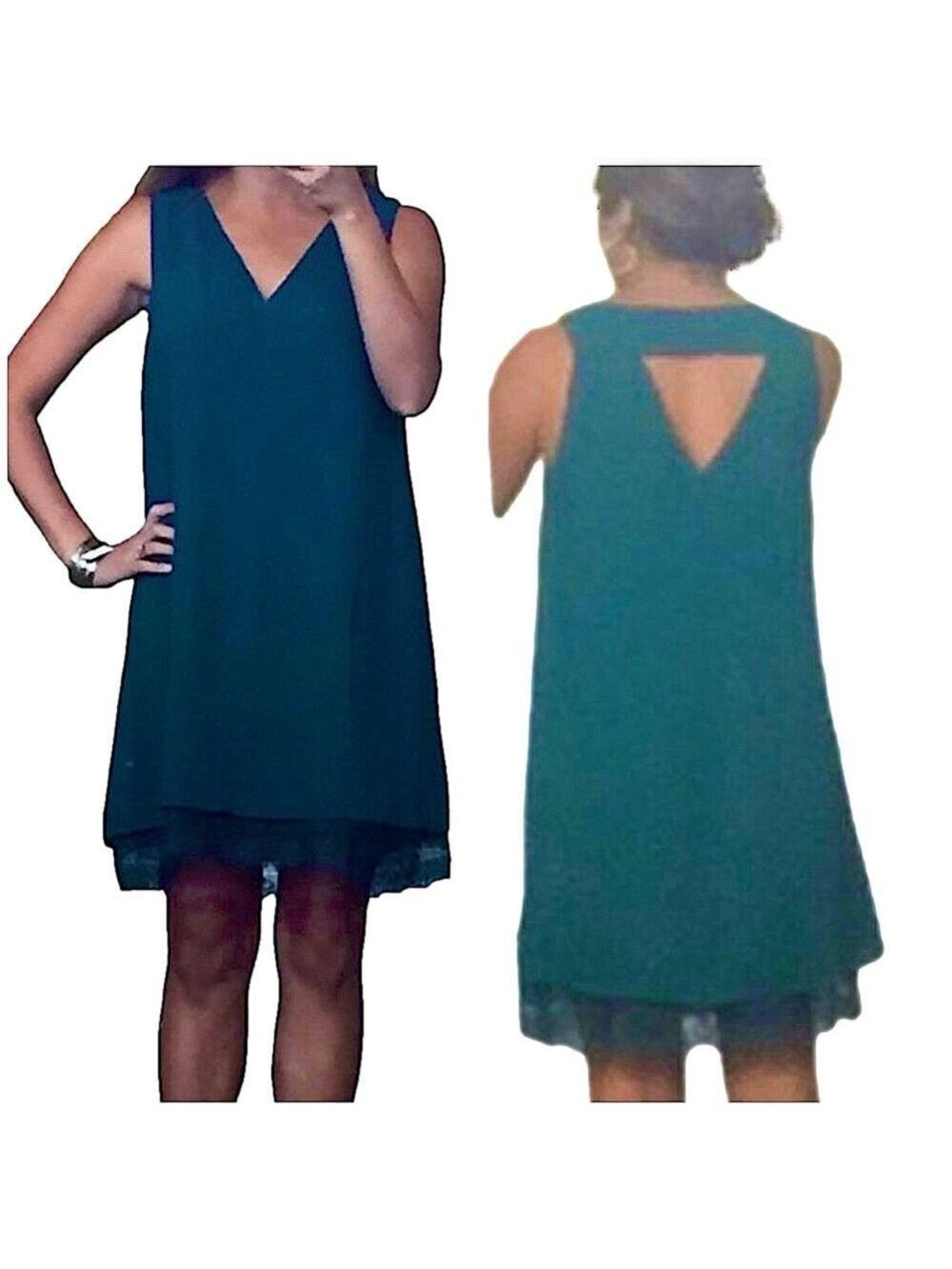 BRIXTON IVY Lace-Hem Shift Dress